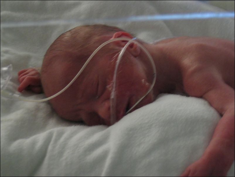 Closeup of Owen